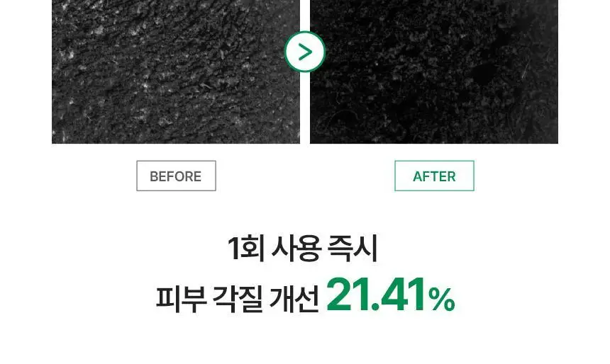 [각질개선/모공관리] 키노닉스 양배추 각질 진정 패드 증정 기획 (70매+10매) 상세페이지 9